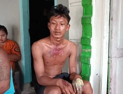 Oknum ASN Bakar Remaja yang Ketahuan Mencuri Ubi, Padahal Pelaku Sudah Minta Maaf