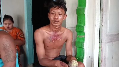Oknum ASN Bakar Remaja yang Ketahuan Mencuri Ubi, Padahal Pelaku Sudah Minta Maaf
